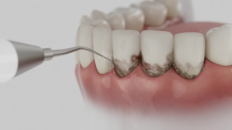 Reliable Dental Implants contractor in Mentor, OH by Smile Center Dentistry